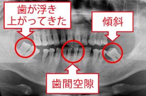 機能の問題001