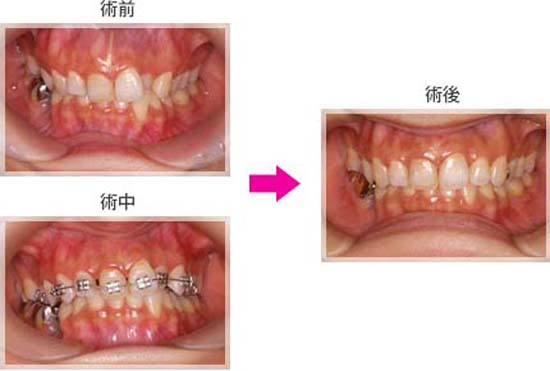 小橋生（MTM）